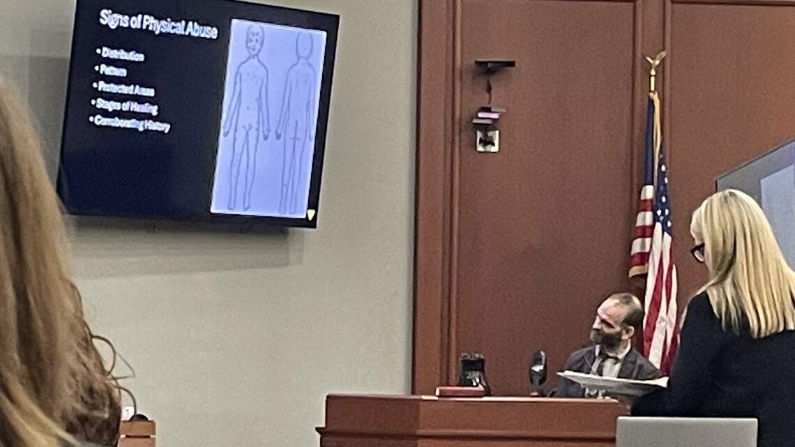 Myrtle Beach area girl ‘tortured,’ expert says. One video shows she was hit 44 times