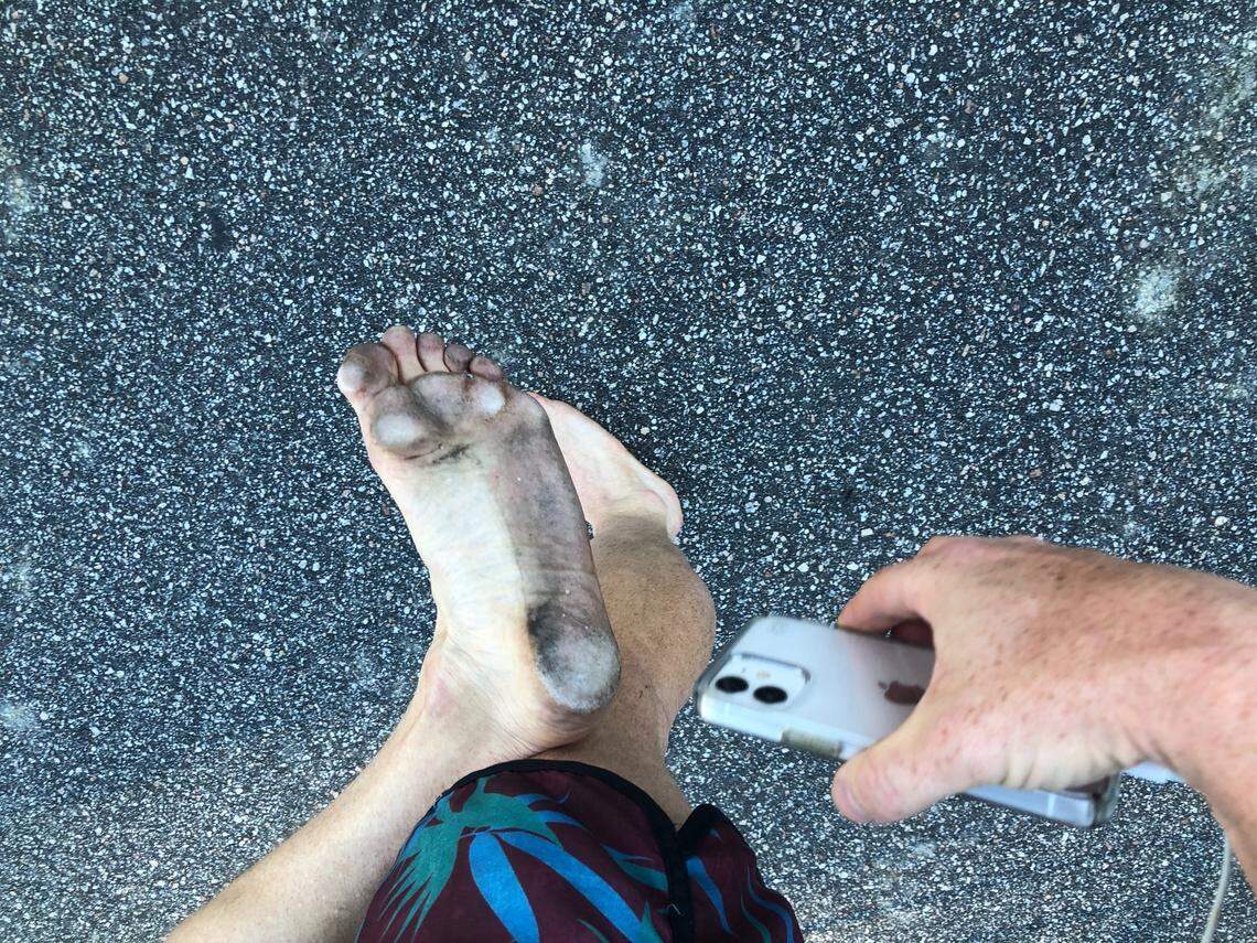 David Tillman of Buies Creek, N.C., ran Saturday’s half marathon in Myrtle Beach barefoot.