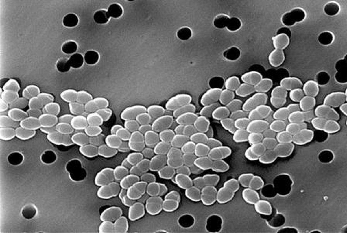 Scanning electron micrograph of enterococci. -