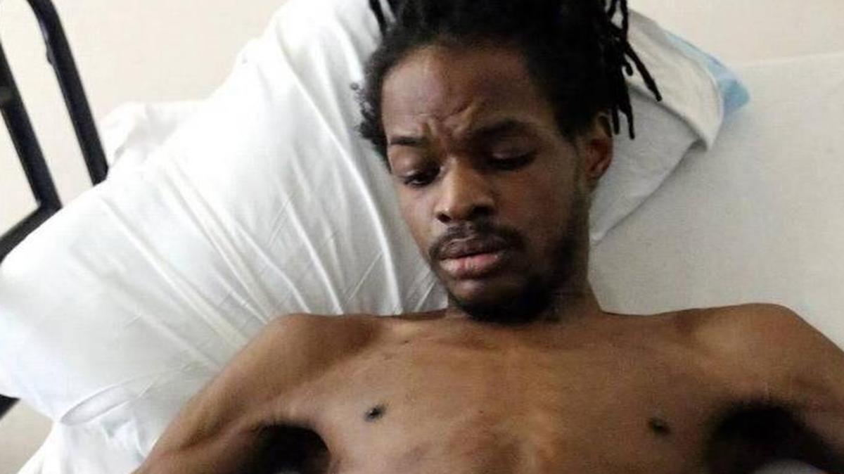 
Julian Betton counts at least nine bullet hole wounds on his body. He doesn’t remember being shot by three officers nor them entering his Withers Swash Drive apartment in April. He said on Friday, July 10, 2015, he remembers going to the bathroom , seeing figures in the hallway coming at him and then waking up from a coma six weeks later and paralyzed in the hospital with a police officer at his bedside. The three officers are with the 15 Circuit Drug Enforcement Unit. They have been cleared of any charges by the State Law Enforcement Division. The SLED report states Betton did not fire at the officers. The shooting happened in the execution of a warrant stemming from a marijuana investigation. Officers seized less than eight ounces of marijuana, $970 in cash, an assault rifle and a handgun in the April 16 incident. Betton has been charged with three counts of possession with intent to distribute but he has not been charged with weapons violations. | By Janet Blackmon Morgan jblackmon@thesunnews.com
