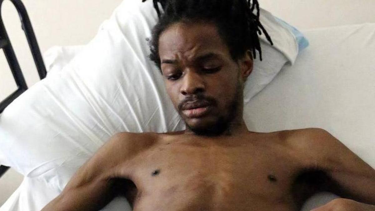 
Julian Betton counts at least nine bullet hole wounds on his body. He doesn’t remember being shot by three officers nor them entering his Withers Swash Drive apartment in April. He said on Friday, July 10, 2015, he remembers going to the bathroom , seeing figures in the hallway coming at him and then waking up from a coma six weeks later and paralyzed in the hospital with a police officer at his bedside. The three officers are with the 15 Circuit Drug Enforcement Unit. They have been cleared of any charges by the State Law Enforcement Division. The SLED report states Betton did not fire at the officers. The shooting happened in the execution of a warrant stemming from a marijuana investigation. Officers seized less than eight ounces of marijuana, $970 in cash, an assault rifle and a handgun in the April 16 incident. Betton has been charged with three counts of possession with intent to distribute but he has not been charged with weapons violations. | By Janet Blackmon Morgan jblackmon@thesunnews.com
